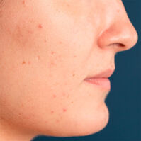 Blue Radiance Enzymatic Serum  30ml-214274 Blue Radiance Enzymatic Serum  30ml-214274 2